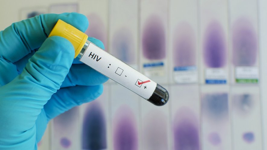 VIH/SIDA Au Tchad : Des Avancées Timides Face A Des Défis Persistants